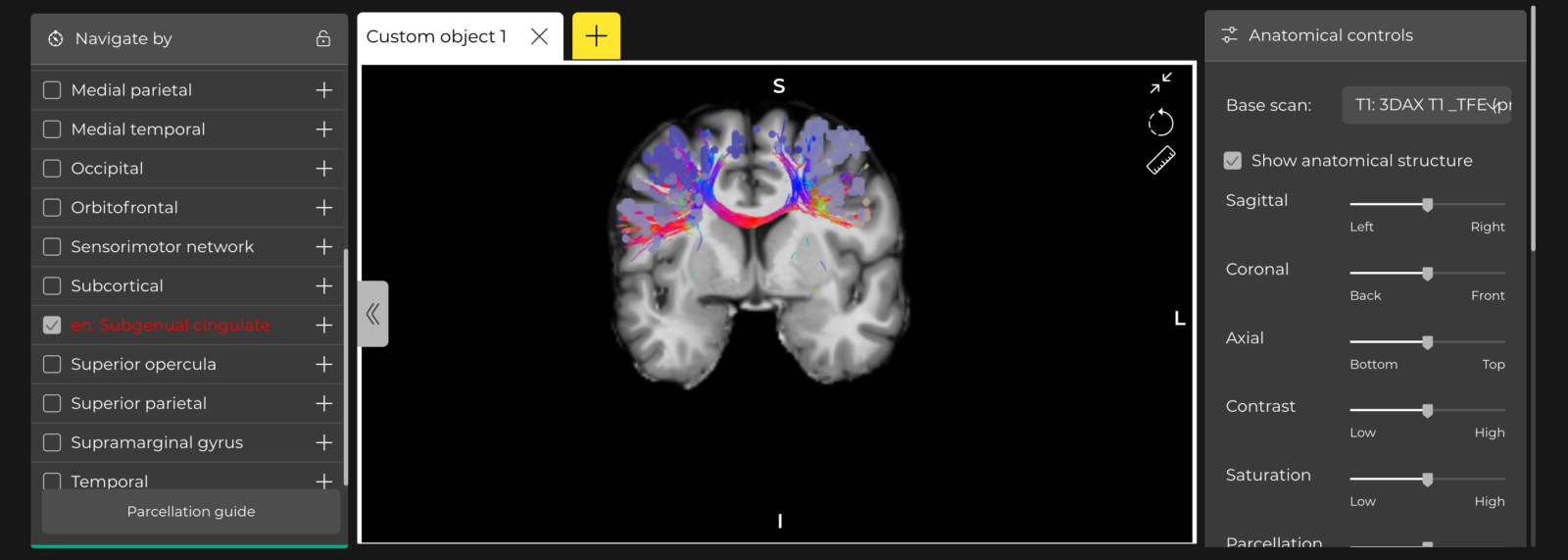 TMS with Neuronavigation - Brain Health Consultants and TMS Center ...